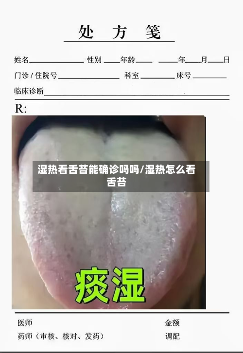 湿热看舌苔能确诊吗吗/湿热怎么看舌苔