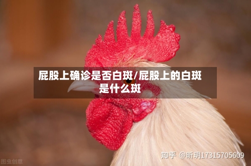 屁股上确诊是否白斑/屁股上的白斑是什么斑-第2张图片