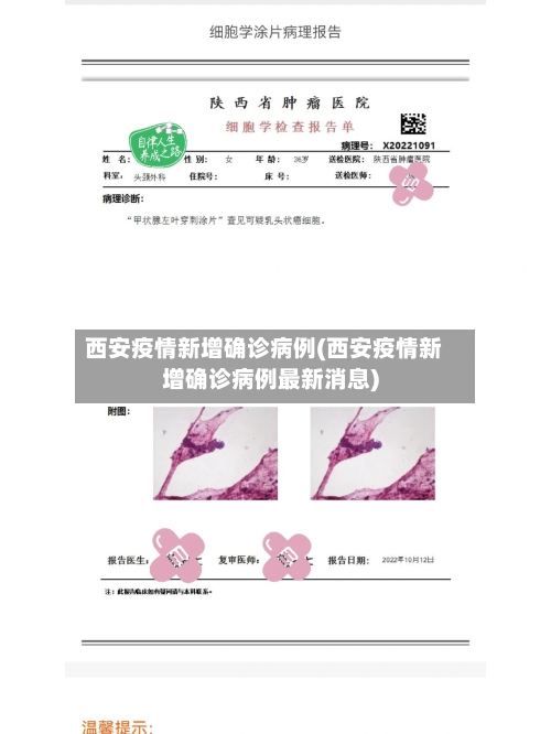 西安疫情新增确诊病例(西安疫情新增确诊病例最新消息)