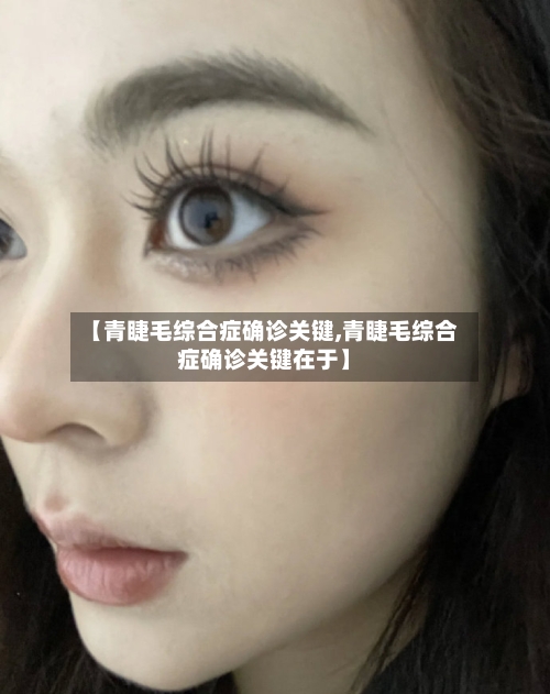 【青睫毛综合症确诊关键,青睫毛综合症确诊关键在于】-第2张图片