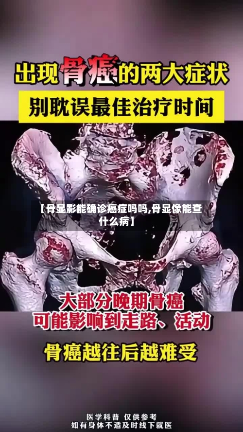 【骨显影能确诊癌症吗吗,骨显像能查什么病】-第3张图片