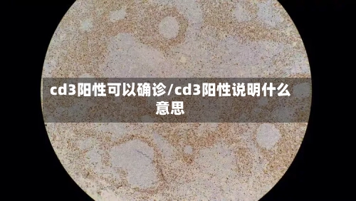 cd3阳性可以确诊/cd3阳性说明什么意思-第3张图片